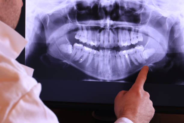 Best Emergency Broken Tooth Repair in Villas, FL